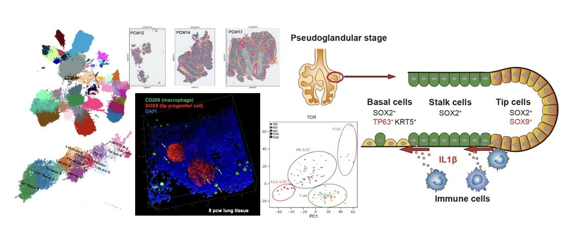 Lung immune cell development